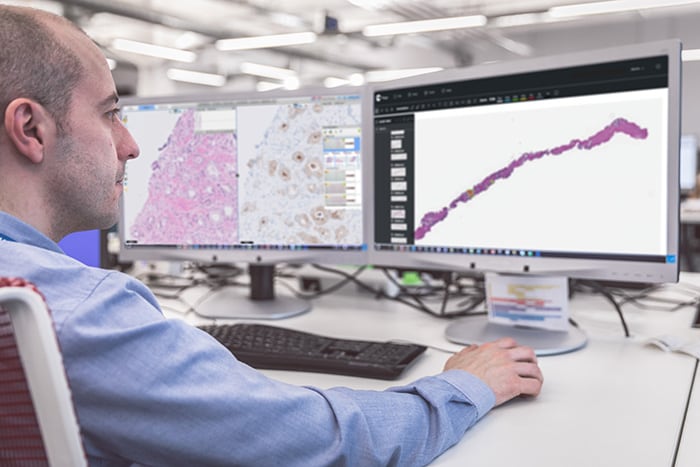 Download image (.jpg) Philips and Paige bring Artifical Intelligence (AI) to clinical pathology diagnostics (opens in a new window)