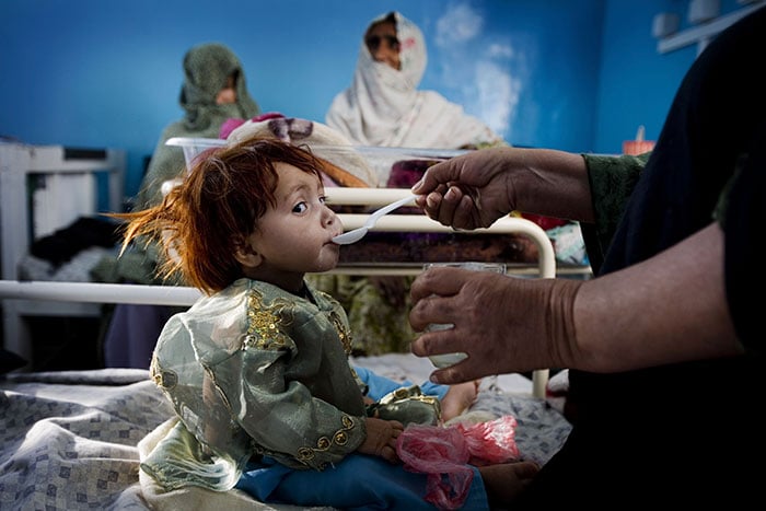 Download image (.jpg) Treating children with pneumonia in Afghanistan (opens in a new window)