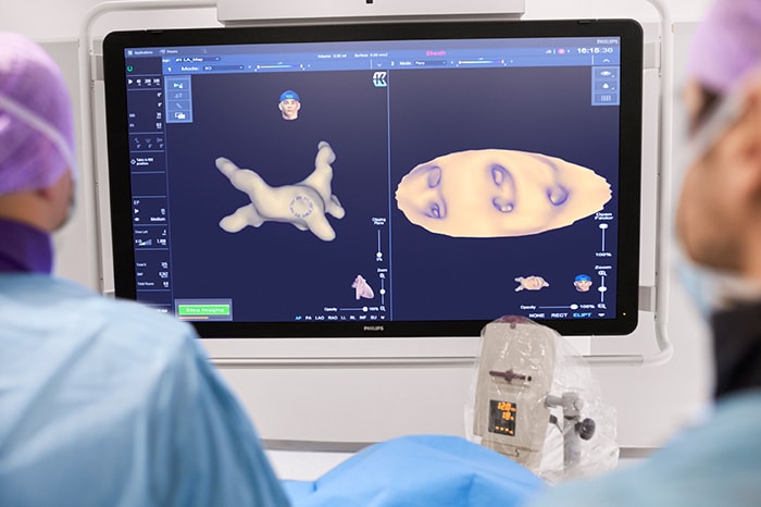 Philips’ KODEX-EPD platform uses dielectric imaging to create high-definition 3D images of a patient’s cardiac structures, in real time