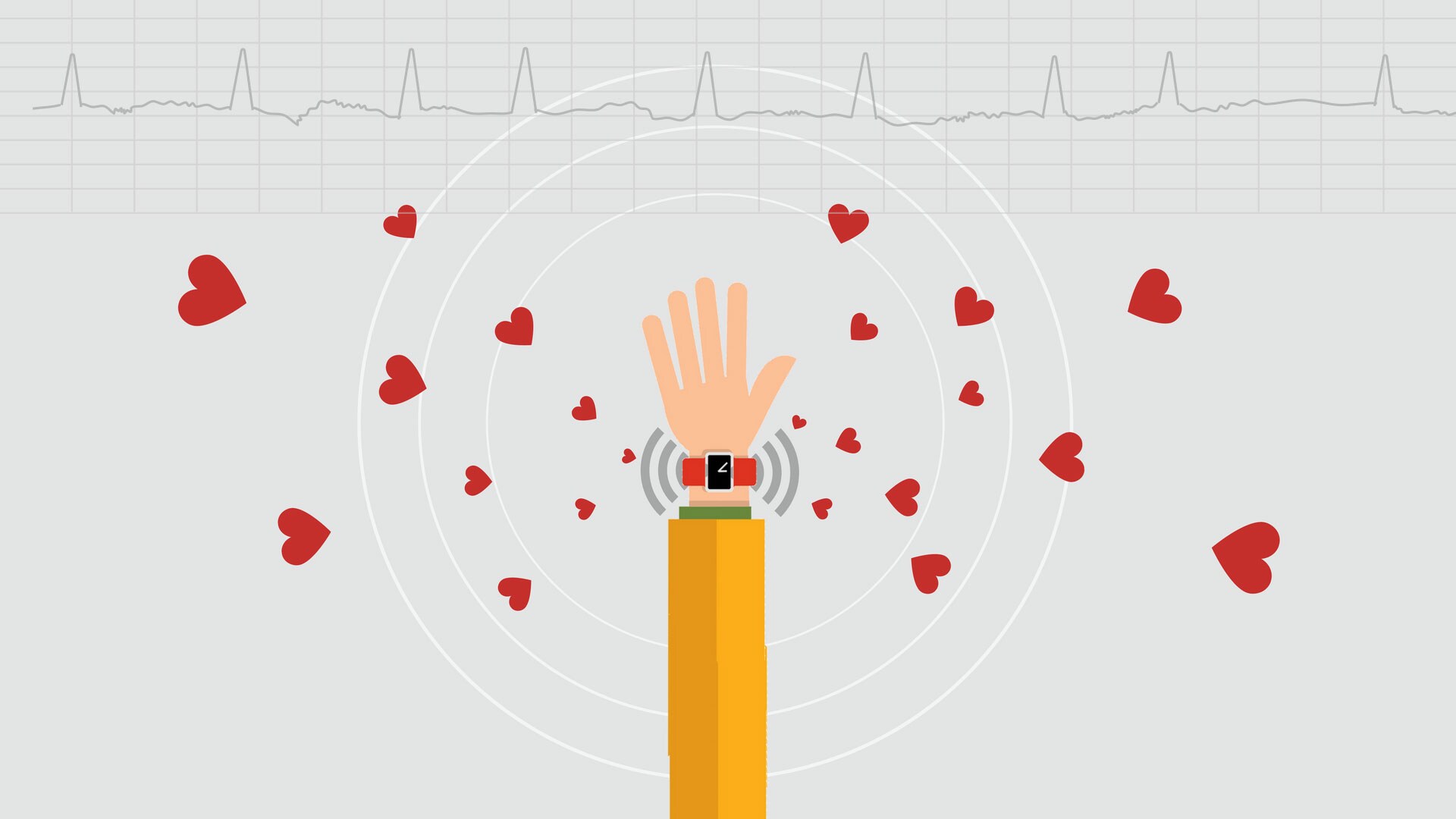 Wearables and AFib: where do we go from here?