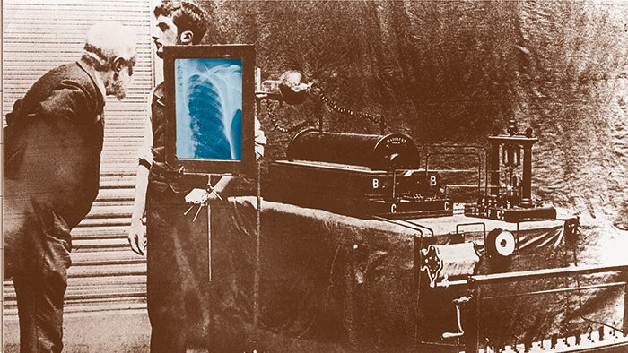 How Philips has been advancing patient care with X-ray for more than a century