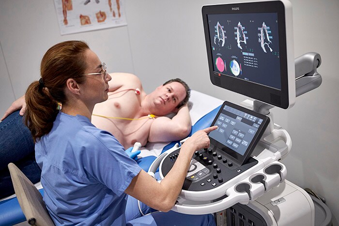 Download image (.jpg) Philips Affiniti CVx dedicated cardiovascular ultrasound