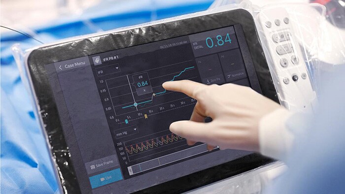 Download image (.jpg) Azurion IntraSight tableside monitor