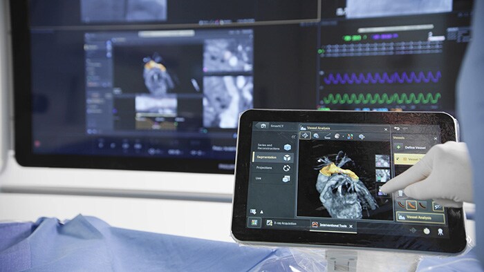 Download image (.jpg) Azurion SmartCT tableside monitor
