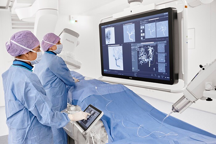 Download image (.jpg) Azurion image-guided therapy platform