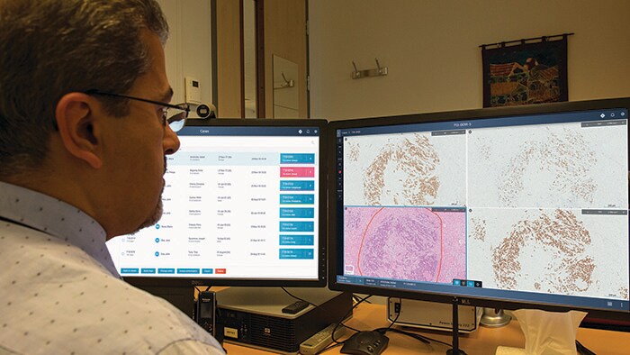 Download image (.jpg) Care team reviewing histopathology slides (opens in a new window)