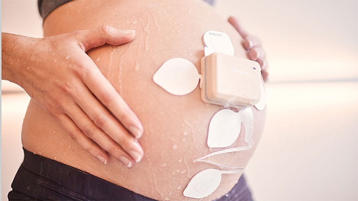 Download image (.jpg) The Avalon Fetal and Maternal Pod and Patch is a single use, disposable patch placed on the mother?s abdomen to capture fetal and maternal vitals without the need for constant repositioning (opens in a new window)