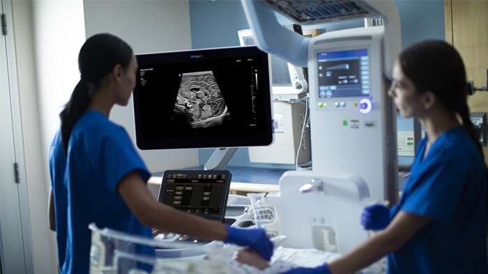 Download image (.jpg) Philips ultimate ultrasound solution for pediatric assessment solution (opens in a new window)