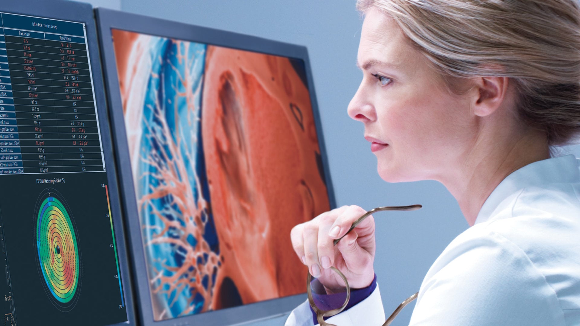 Philips debuts AI-enabled, automated Radiology Workflow Suite at RSNA 2020