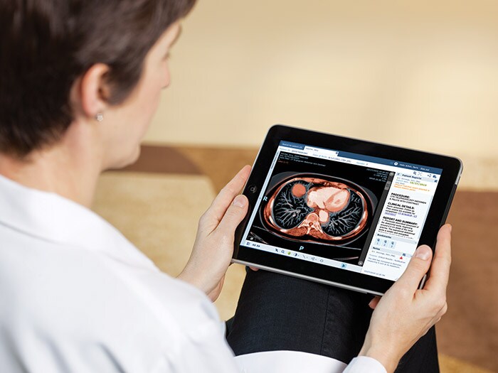 Download image (.jpg) Philips Image Viewer Vue Motion for Clinicans (opens in a new window)