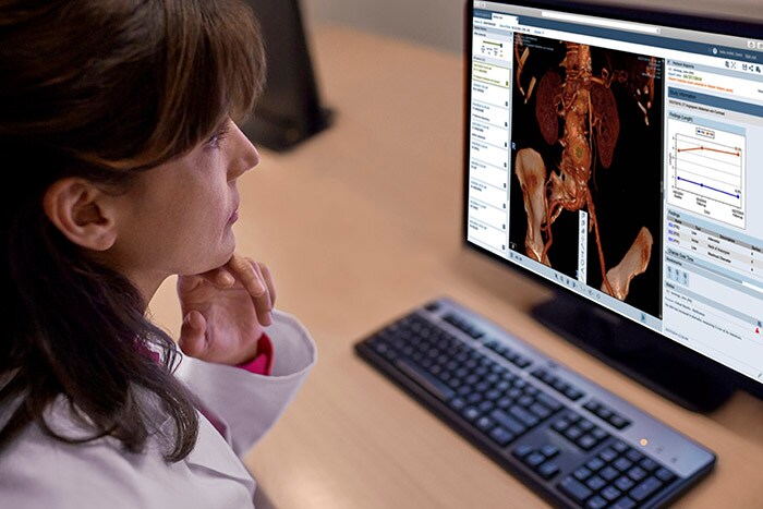 Download image (.jpg) Philips Vue Motion for Radiologists (opens in a new window)