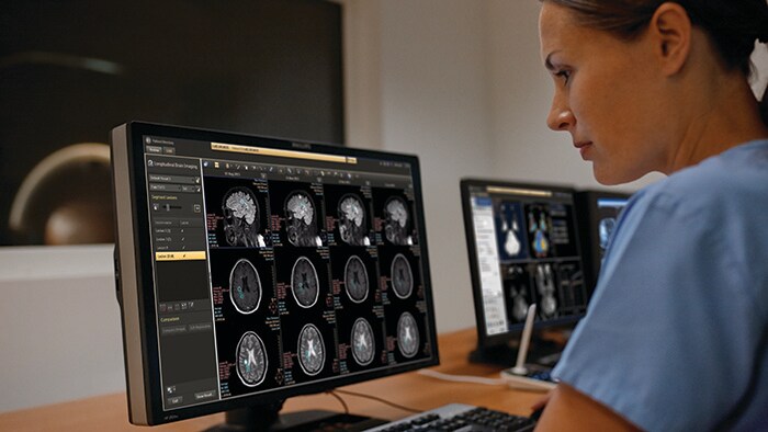 Philips designated a Health Information Exchange stalwart in Chilmark Research Market Trends Report