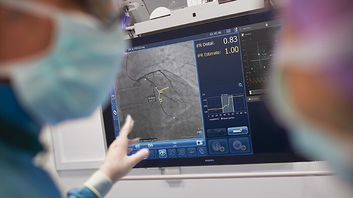Philips announces first patient enrollment in DEFINE GPS global multicenter study to assess superiority of PCI procedures guided by co-registered iFR and interventional angiography