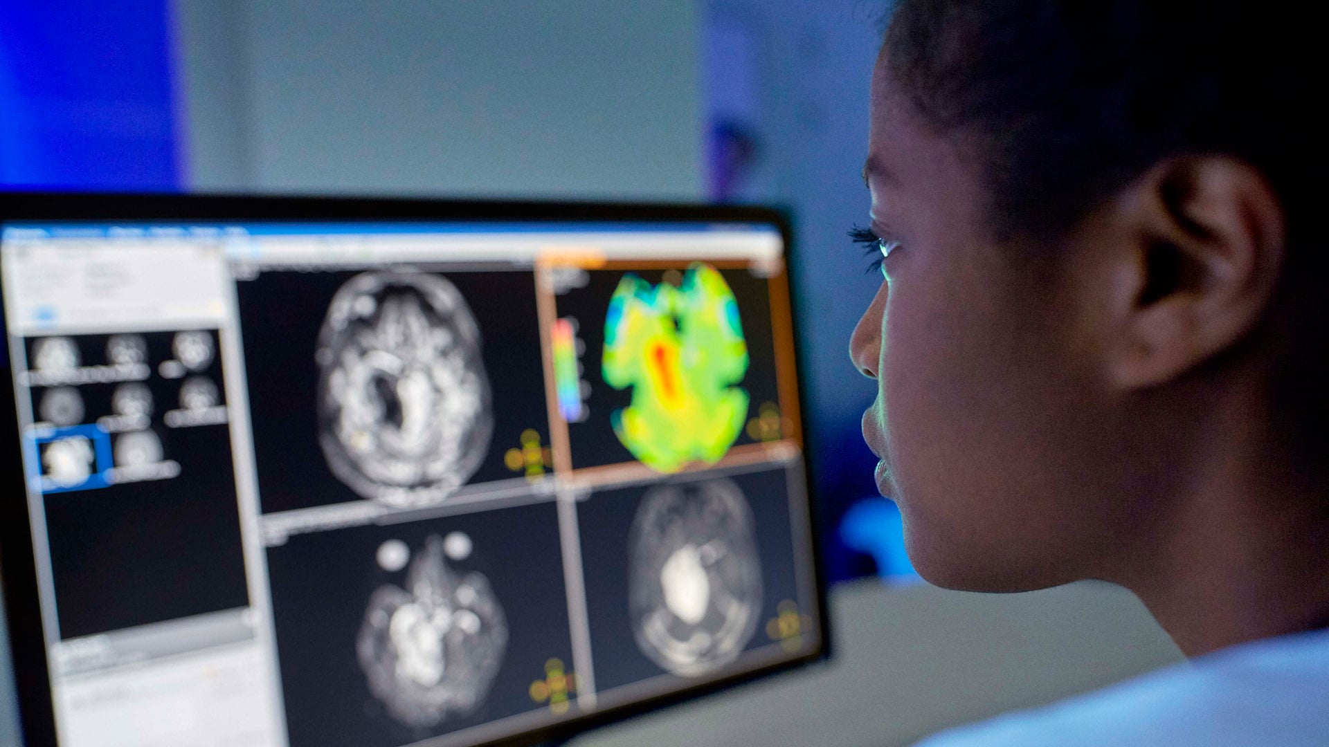 Philips spotlights new integrated informatics and system solutions to drive workflow optimization and advance precision diagnosis at ECR 2021