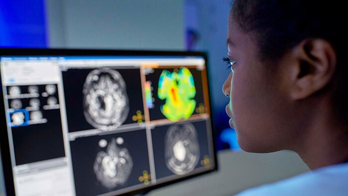 Philips spotlights new integrated informatics and system solutions to drive workflow optimization and advance precision diagnosis at ECR 2021