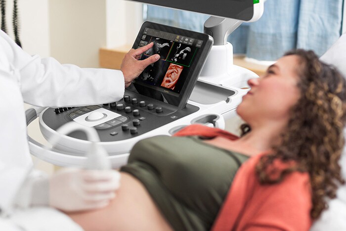 Download image (.jpg) Obstetrics ultrasound imaging shown on the EPIQ Elite (opens in a new window)