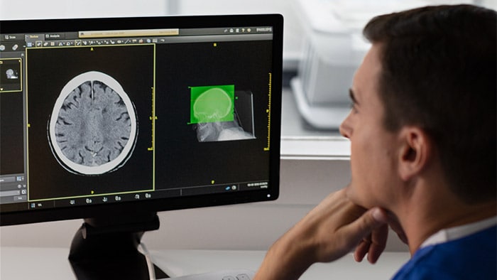 Philips Incisive CT gets even smarter with debut of AI-enabled Precise Suite