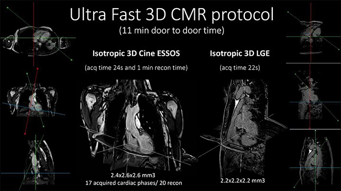 Download image (.jpg) Ultra fast 3C CMR protocoll (opens in a new window)