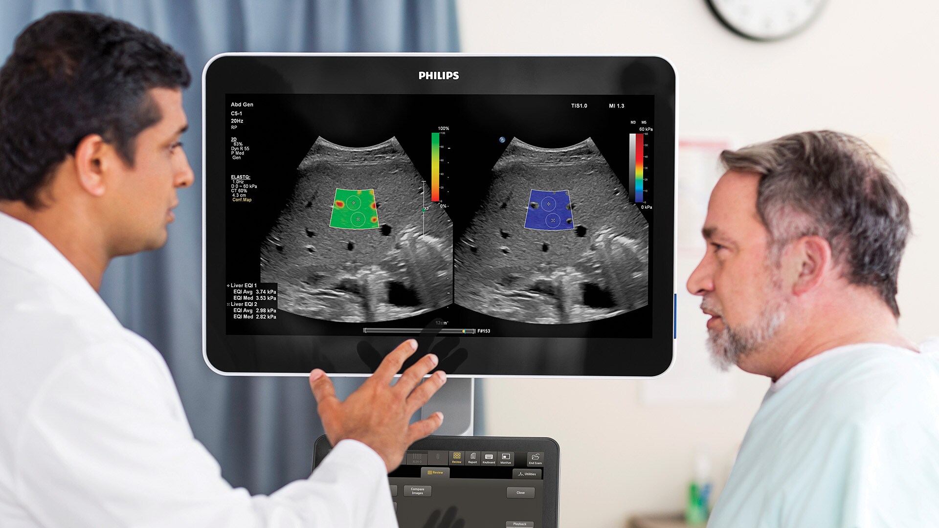 Philips advances ultrasound portfolio with new robust imaging tools and features for Radiology to increase diagnostic confidence and workflow efficiency