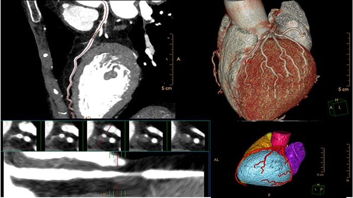 Philips highlights portfolio of radiology workflow solutions at RSNA