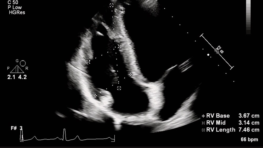 Download image (.jpg) (opens in a new window) Two doctors reviewing mammogram case