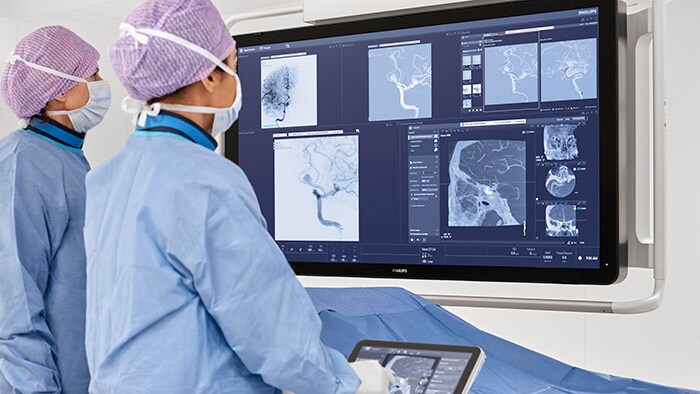 Download image (.jpg) (opens in a new window) Philips Azurion with Neuro suite