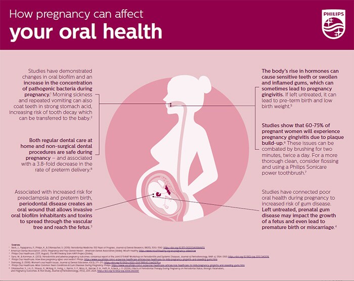 Premature births: Chewing gum while pregnant linked to lower risk