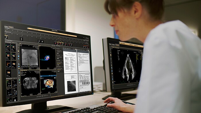 Cardiovascular Workspace image and information management solution in use