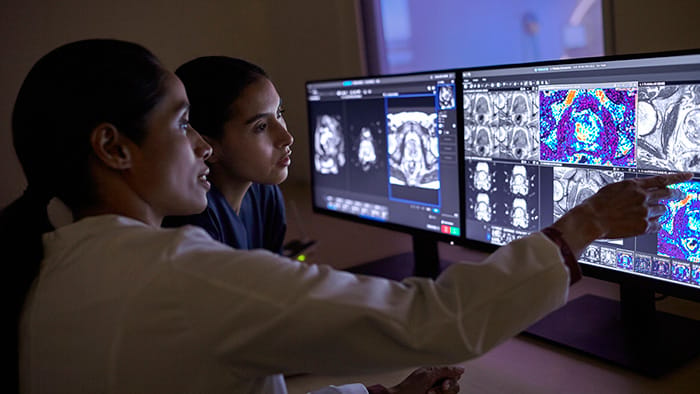 Philips integrates Quibim AI into MR prostate exams - News | Philips