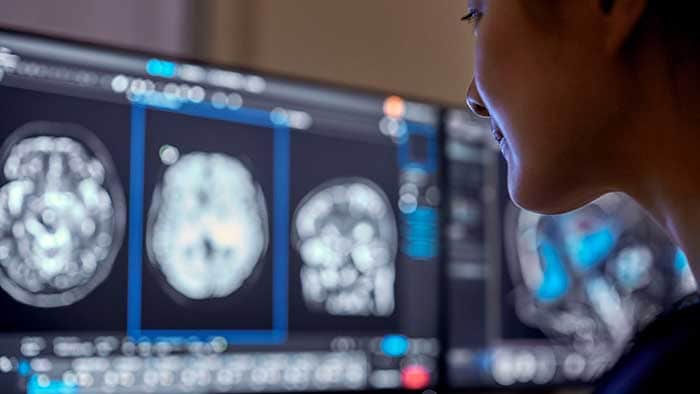 Philips unveil new AI-enabled imaging innovations at #RSNA – News