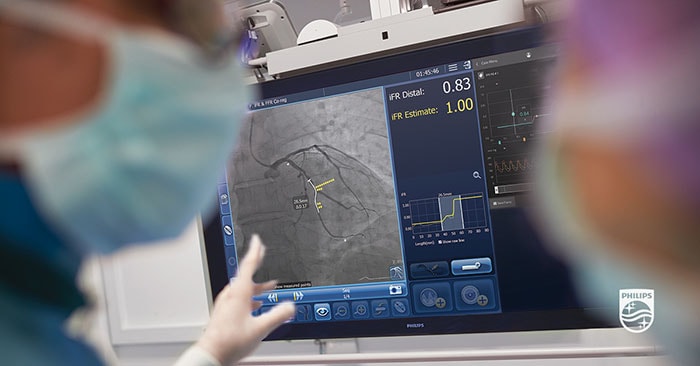 Philips iFR co registratiion SyncVision clinicians