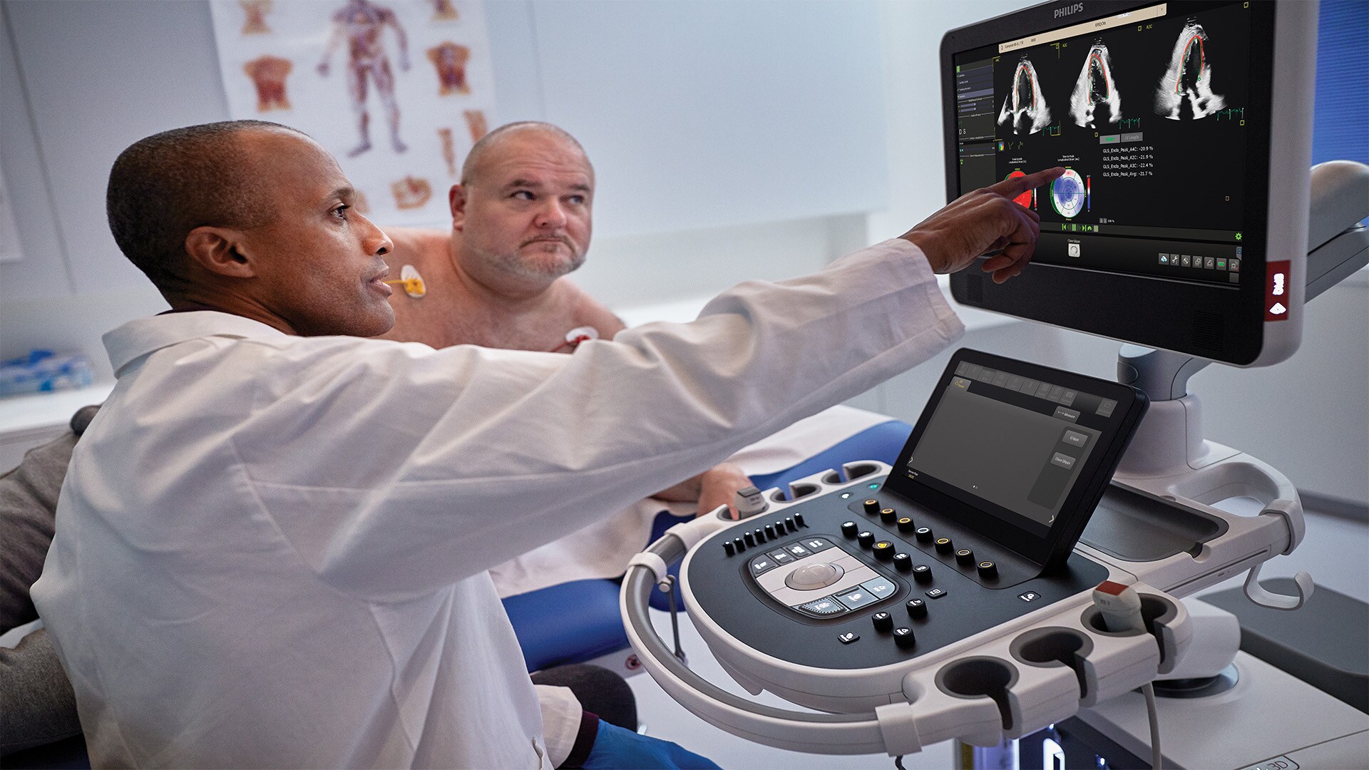AI in cardiovascular ultrasound to diagnose more patients