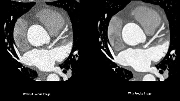A clinical CT5300 cardiac scan image -  