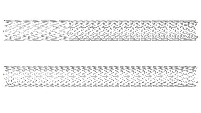 Duo Venous Stent System -  