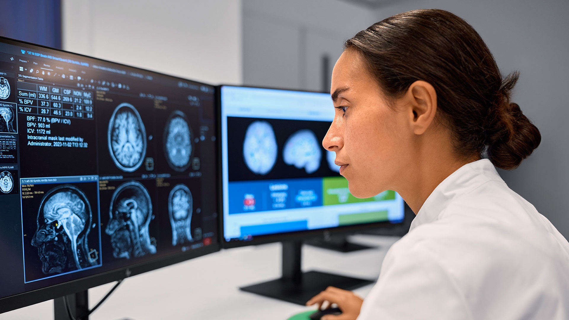 Philips and icometrix advance precision diagnosis in neurology with innovative AI-based imaging solutions at #RSNA24