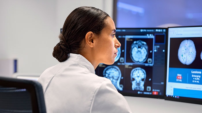 MR technologist reviews neuro images in icometrix AI reporting tool -  