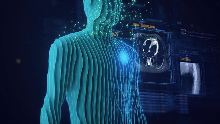 Advancing cardiac MRI technology through AI -  