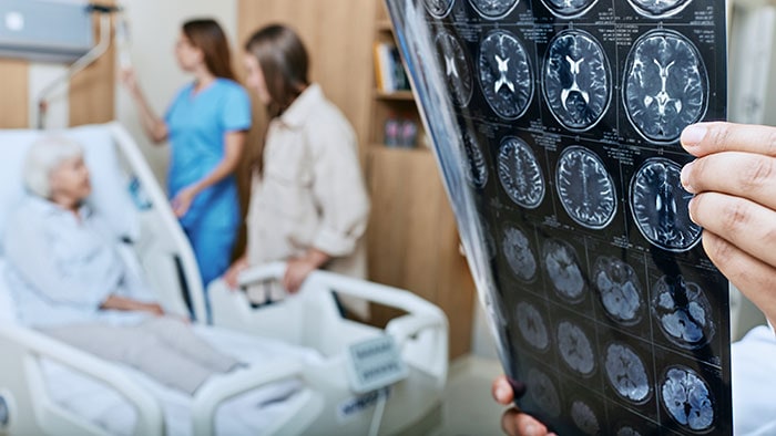 Stroke patient recovering -  