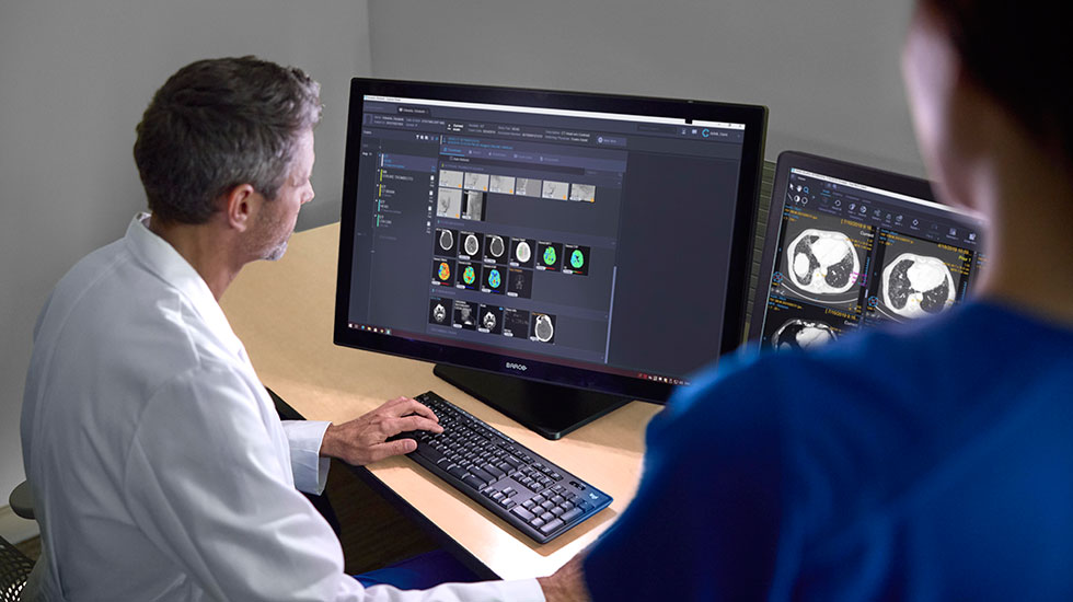 Radiologist looking at lung CT scan