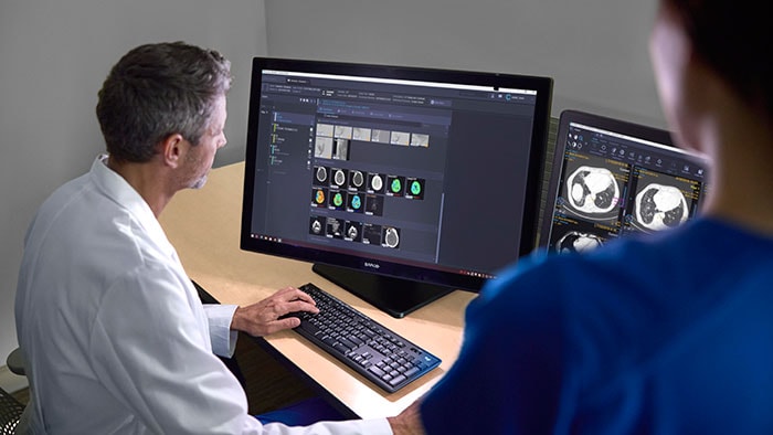 Radiologist looking at lung CT scan -  