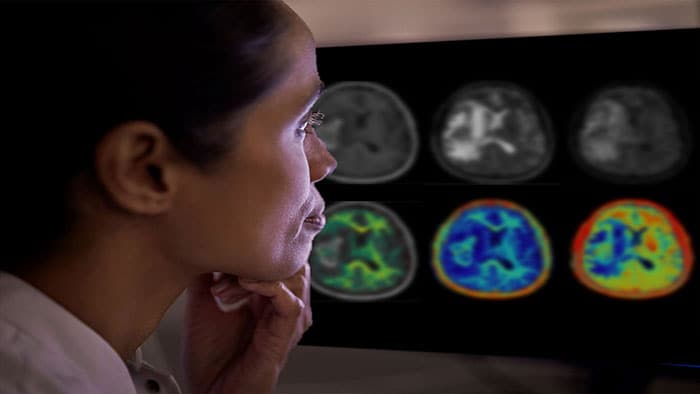 Clinician assesses brain tissue types -   