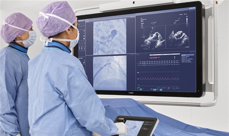 Doctors focusing on screen during a procedure