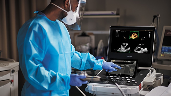 Philips unveils AI-powered enhancements for Compact Ultrasound 5500CV, expanding advanced cardiac imaging to more patients