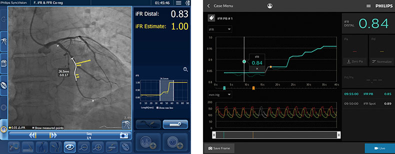 DEFINE GPS iFR