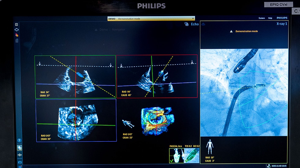 DeviceGuide screen content -  