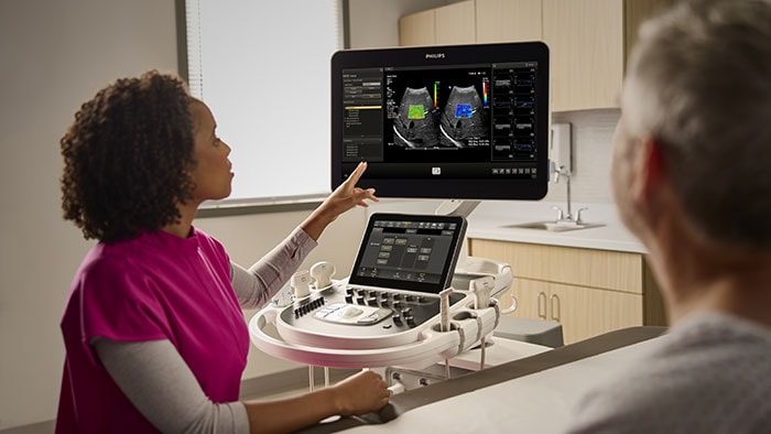 New automated workflow and quantitative measurement functions in ultrasound speed exams and increase clinical confidence -  