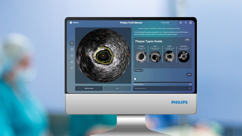 IVUS Mentor