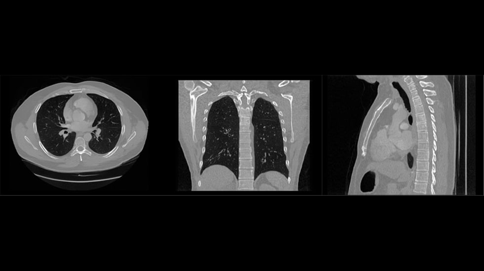 Synthetic chest CT images generated using advanced algorithms rather than patient data