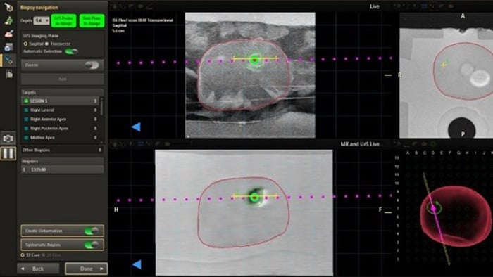 UroNav with advanced annotation -  