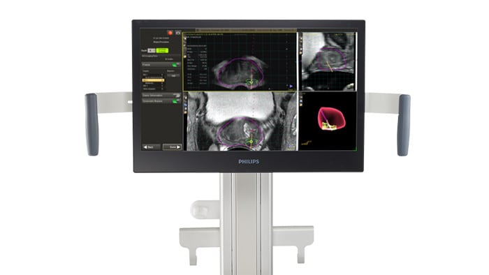 UroNav cart with advanced annotation option -  
